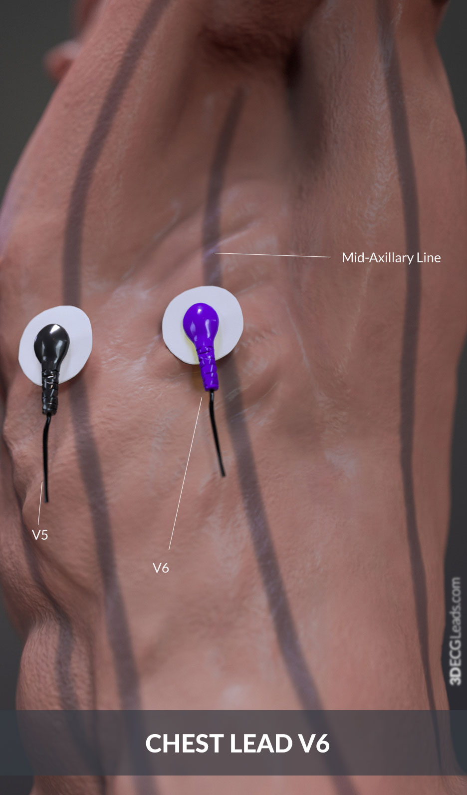 where to place ecg leads on chest